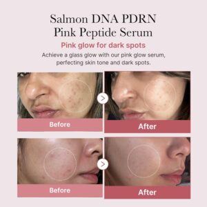 medicube Salmon DNA PDRN Pink Peptide Serum, Pink glow serum, Peptide, Niacinamide, Hydrating & Moisturizing & Firming, Uneven Skin Tone, Korean Skincare | 1.01 fl.oz. (1.01 fl.oz., Salmon DNA PDRN) - Image 4