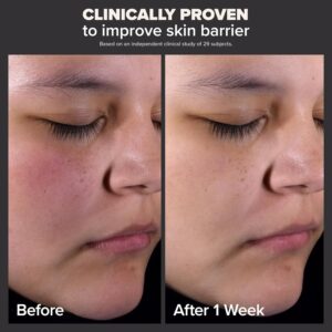 Paula's Choice SKIN PERFECTING 2% BHA Liquid Salicylic Acid Exfoliant-Facial Exfoliant for Blackheads, Enlarged Pores, Wrinkles & Fine Lines - Image 6