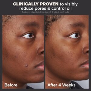 Paula's Choice SKIN PERFECTING 2% BHA Liquid Salicylic Acid Exfoliant-Facial Exfoliant for Blackheads, Enlarged Pores, Wrinkles & Fine Lines - Image 5